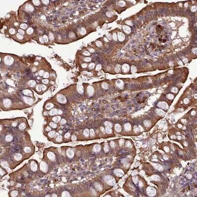 Immunohistochemistry-Paraffin: Adenosylhomocysteinase/AHCY Antibody [NBP2-48817]