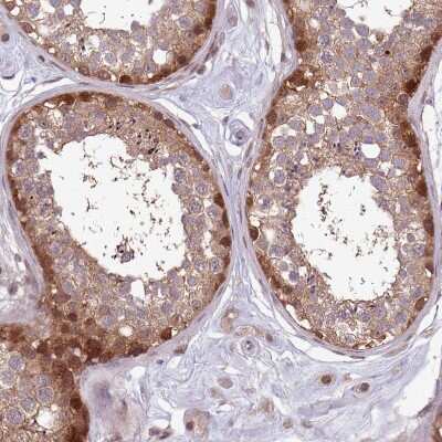 Immunohistochemistry-Paraffin: Adenosylhomocysteinase/AHCY Antibody [NBP2-48817]