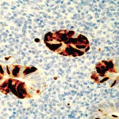 Immunohistochemistry: Adenovirus Antibody (M58 + M73) [NB120-3648]