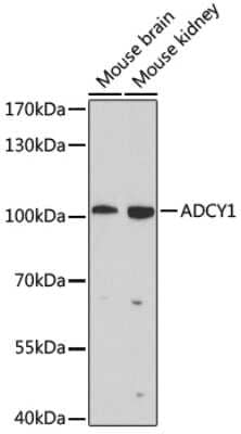 Western Blot: Adenylate Cyclase 1 AntibodyBSA Free [NBP2-92583]