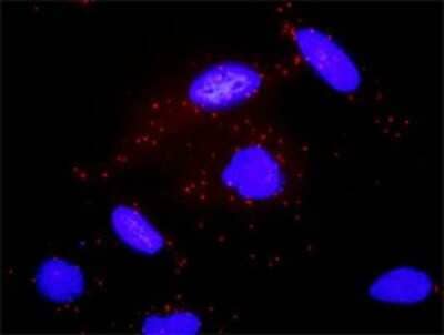 Proximity Ligation Assay: Adenylate Cyclase 2 Antibody (1D4) [H00000108-M01]