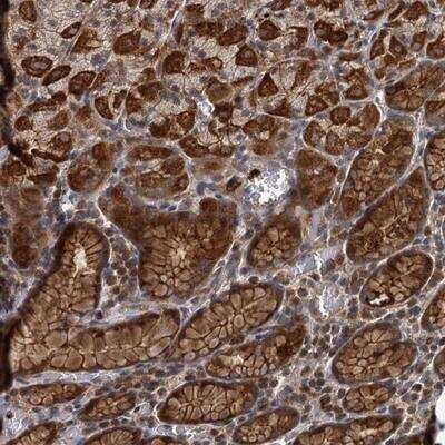 Immunohistochemistry: Adenylate Cyclase 2 Antibody [NBP1-90280]