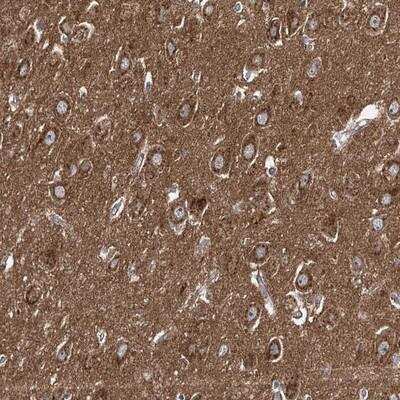 Immunohistochemistry: Adenylate Cyclase 2 Antibody [NBP1-90281]