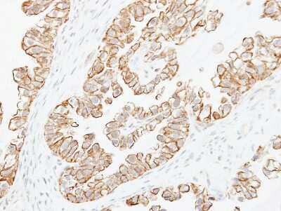 Immunohistochemistry-Paraffin: Adenylate Cyclase 2 Antibody [NBP1-33659]