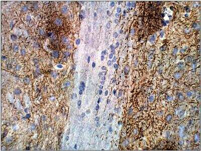 Immunohistochemistry-Paraffin: Adenylate Cyclase 2 Antibody [NBP3-12215]
