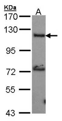 Western Blot: Adenylate Cyclase 2 Antibody [NBP1-33659]