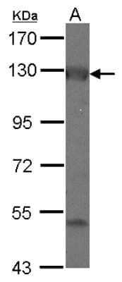 Western Blot: Adenylate Cyclase 2 Antibody [NBP2-15292]