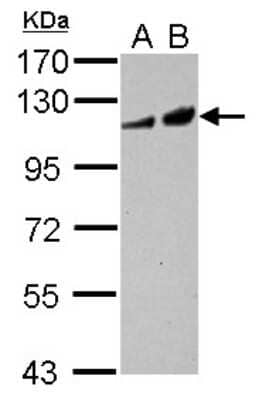 Western Blot: Adenylate Cyclase 2 Antibody [NBP2-15293]