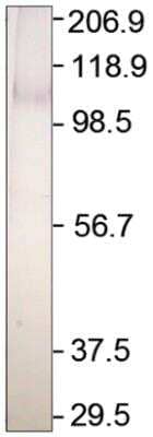 Western Blot: Adenylate Cyclase 2 Antibody [NBP3-12215]