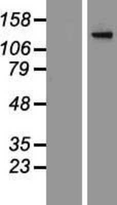 Western Blot: Adenylate Cyclase 2 Overexpression Lysate [NBP2-06631]