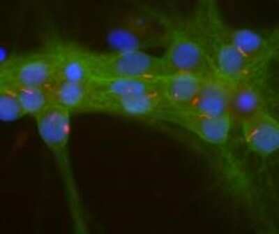Immunocytochemistry/ Immunofluorescence: Adenylate Cyclase 3 Antibody [NBP2-60792]