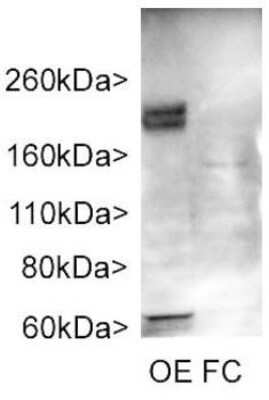 Western Blot: Adenylate Cyclase 3 Antibody [NBP1-92683]
