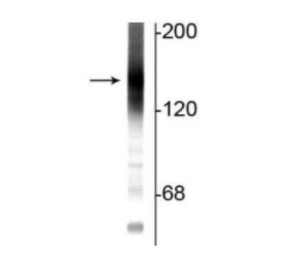 Western Blot: Adenylate Cyclase 3 Antibody [NBP2-60792]