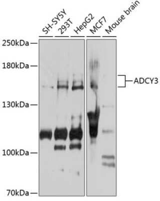 Western Blot: Adenylate Cyclase 3 AntibodyBSA Free [NBP2-92522]