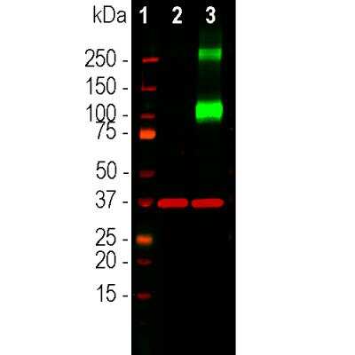 Western Blot: Adenylate Cyclase 3 Antibody [NBP3-05526]