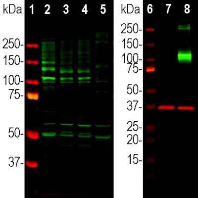 Western Blot: Adenylate Cyclase 3 Antibody [NBP3-05527]