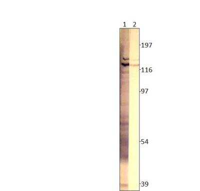 Western Blot: Adenylate Cyclase 3 Antibody [NBP3-12369]