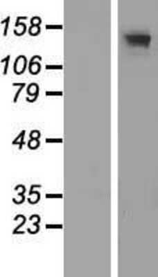 Western Blot: Adenylate Cyclase 3 Overexpression Lysate [NBP2-10559]