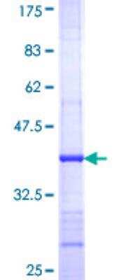 SDS-PAGE: Recombinant Human Adenylate Cyclase 3 GST (N-Term) Protein [H00000109-Q01]