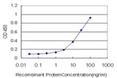 ELISA: Adenylate Cyclase 5 Antibody (3E6) [H00000111-M01]