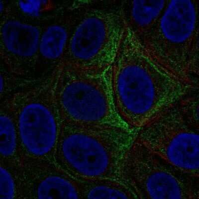 Immunocytochemistry/ Immunofluorescence: Adenylate Cyclase 5 Antibody [NBP2-57976]