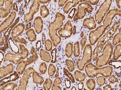 Immunohistochemistry-Paraffin: Adenylate Cyclase 5 Antibody [NBP3-06369]