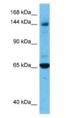 Western Blot: Adenylate Cyclase 5 Antibody [NBP3-10868]