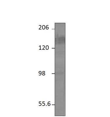 Western Blot: Adenylate Cyclase 5 Antibody [NBP3-12216]