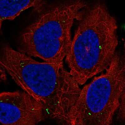 Immunocytochemistry/ Immunofluorescence: Adenylate Cyclase 7 Antibody [NBP2-58945]