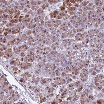 Immunohistochemistry-Paraffin: Adenylate Cyclase 7 Antibody [NBP2-14268]