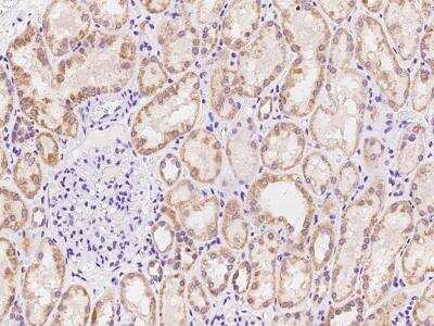 Immunohistochemistry-Paraffin: Adenylate Cyclase 7 Antibody [NBP2-97909]