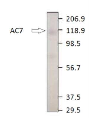 Western Blot: Adenylate Cyclase 7 Antibody [NBP3-12217]