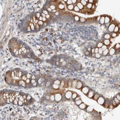 Immunohistochemistry-Paraffin: Adenylate Cyclase 8 Antibody [NBP1-90278]