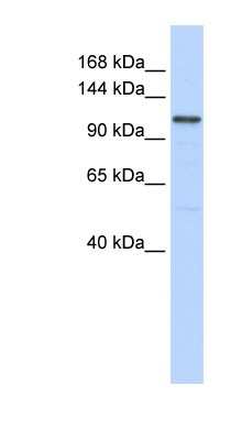 Western Blot: Adenylate Cyclase 8 Antibody [NBP1-59027]