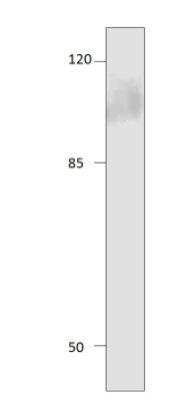 Western Blot: Adenylate Cyclase 8 Antibody [NBP3-12506]