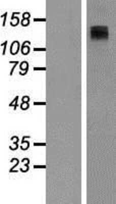 Western Blot: Adenylate Cyclase 8 Overexpression Lysate [NBP2-10953]