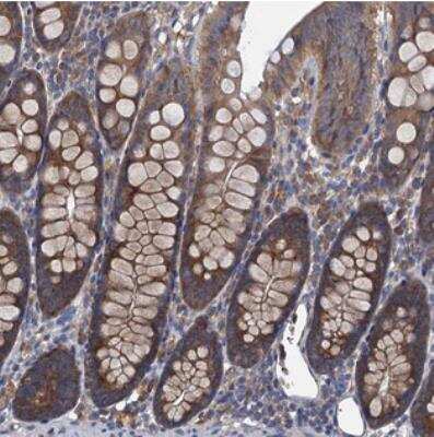 Immunohistochemistry: Adenylate Cyclase 9 Antibody [NBP2-30436]