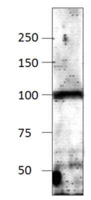 Western Blot: Adenylate Cyclase 9 Antibody [NBP3-12218]