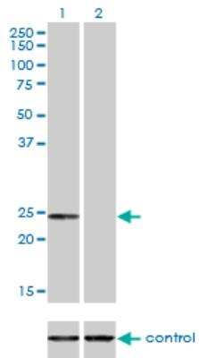 Western Blot: Adenylate Kinase 1 Antibody (3A6-1F5) [H00000203-M06]