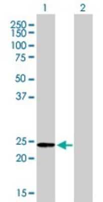 Western Blot: Adenylate Kinase 1 Antibody (3A6-1F5) [H00000203-M06]