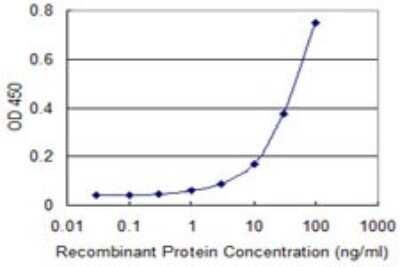 ELISA: Adenylate Kinase 1 Antibody (3G8-1B11) [H00000203-M01]