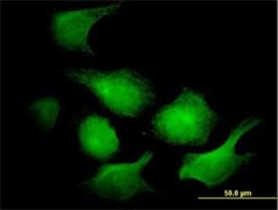 Immunocytochemistry/ Immunofluorescence: Adenylate Kinase 1 Antibody (3G8-1B11) [H00000203-M01]