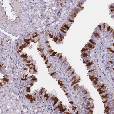 Immunohistochemistry-Paraffin: Adenylate Kinase 1 Antibody [NBP1-87401]