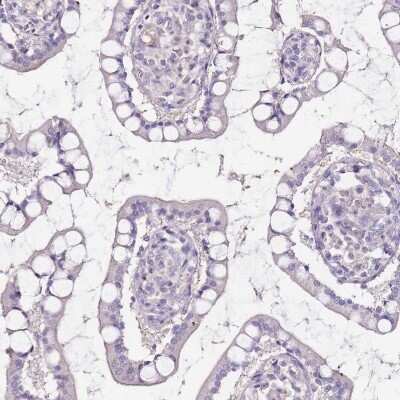 Immunohistochemistry-Paraffin: Adenylate Kinase 1 Antibody [NBP1-87401]