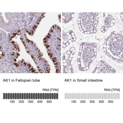 Immunohistochemistry-Paraffin: Adenylate Kinase 1 Antibody [NBP1-87401]