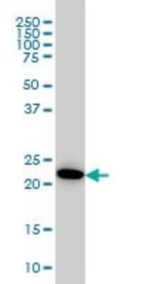 Western Blot: Adenylate Kinase 1 Antibody (M1) [H00000203-M08]