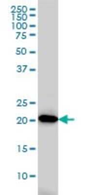 Western Blot: Adenylate Kinase 1 Antibody (M2) [H00000203-M09]