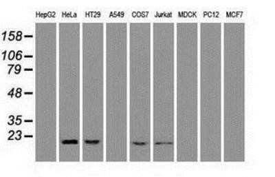 Western Blot: Adenylate Kinase 1 Antibody (OTI4A1)Azide and BSA Free [NBP2-70123]