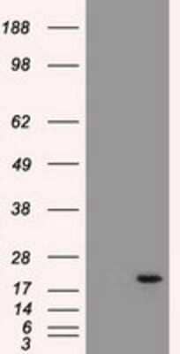 Western Blot: Adenylate Kinase 1 Antibody (OTI4A1)Azide and BSA Free [NBP2-70123]