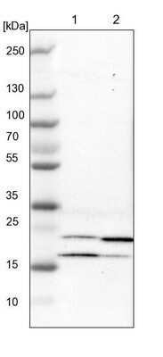 Western Blot: Adenylate Kinase 1 Antibody [NBP1-87401]